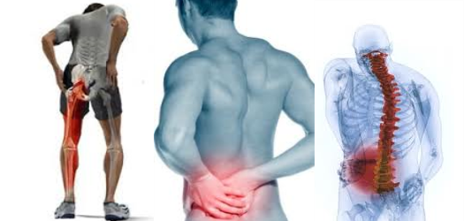 Sciatica Pain Relief San Diego Chiropractor